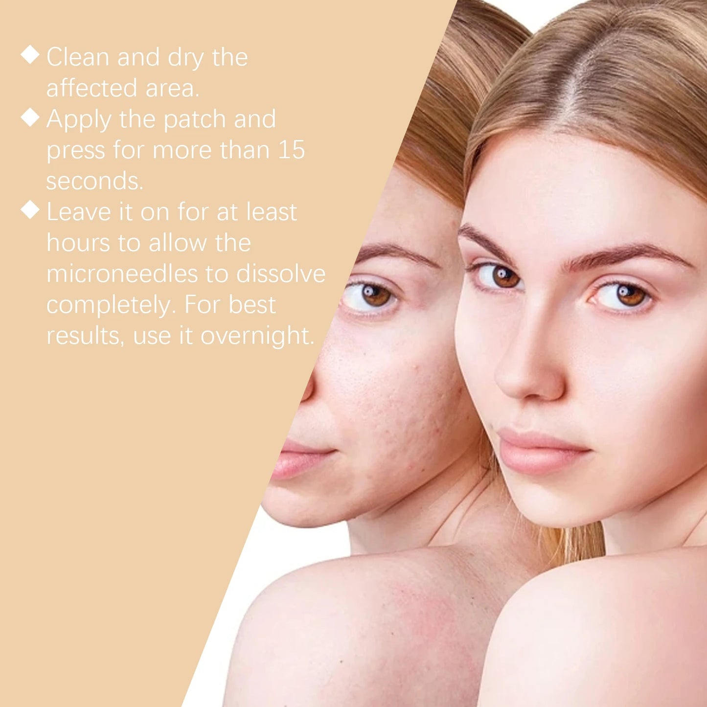 Large-Size Acne Patches Gently Cleanse And Care For Skin Hydrating And Moisturizing Improve Acne Daily Care Patches